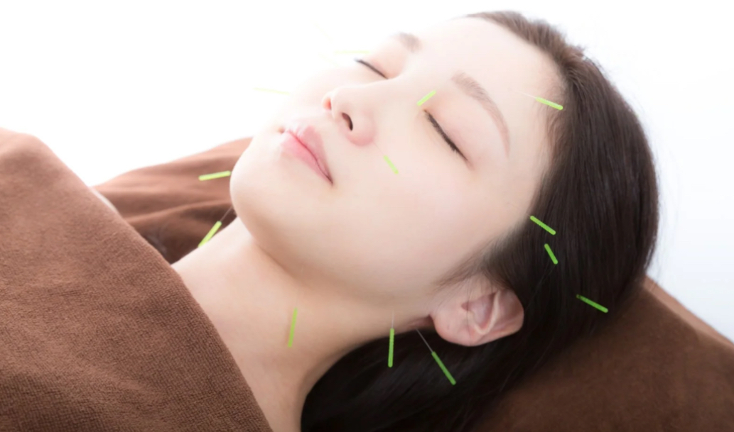 美容鍼灸 顔の施術風景